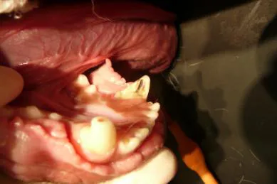 root canal treatment pulp exposed